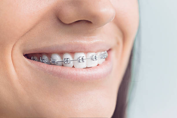 Why Choose Us for Your Dental Needs in Jonesville, MI